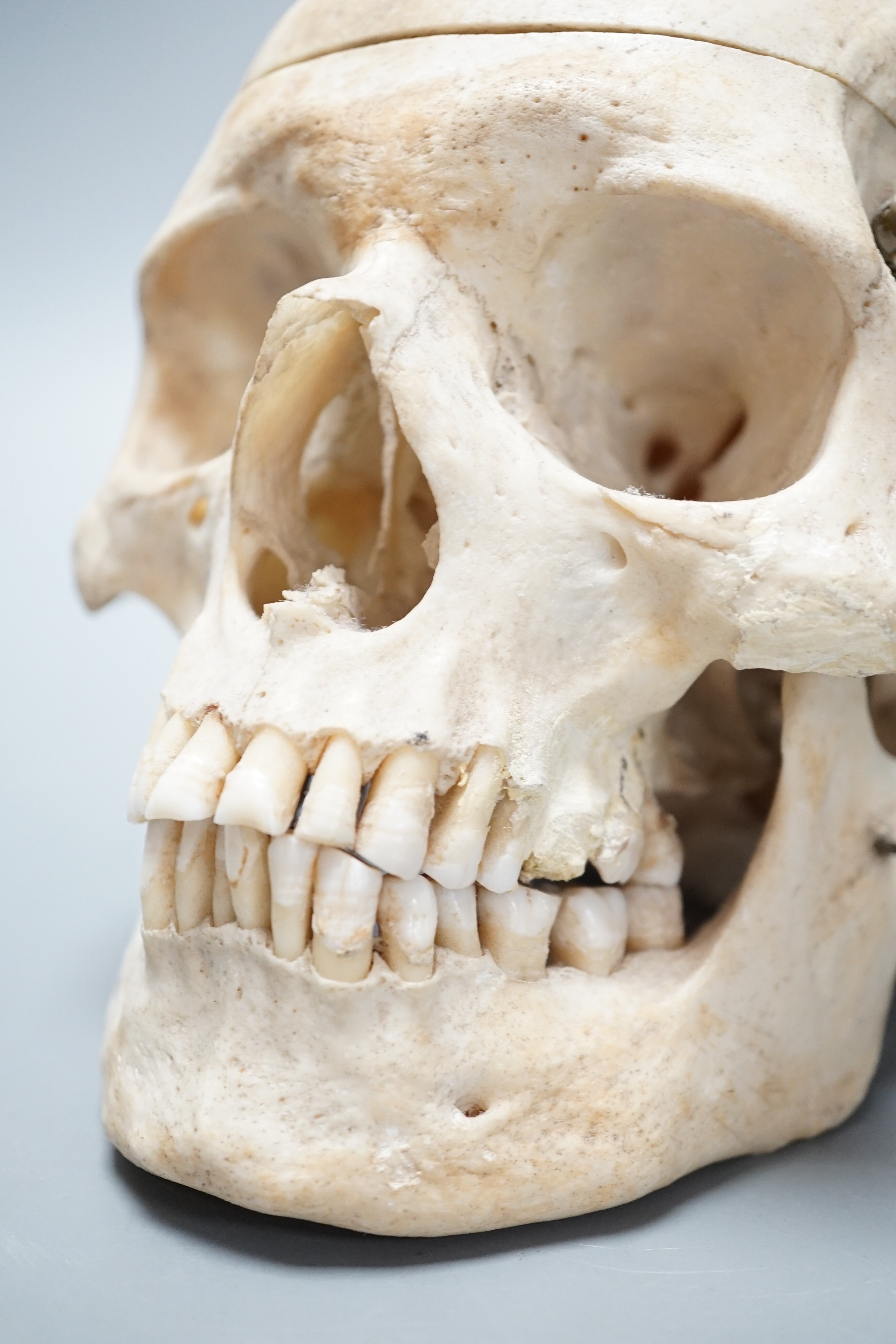 A human skull with removable cranium and spring loaded jaw 15.5cm